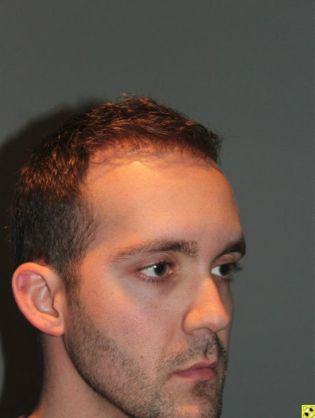 after photo from the side