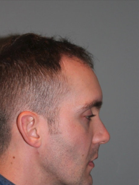 before photo from the profile