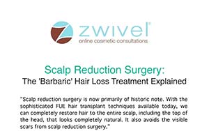 Zwivel article header on scalp reduction surgery, describing it as a historic hair loss treatment with a brief text about advances in FUE hair transplant methods.