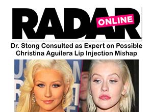 Radar Online article headline about Dr. Stong's expert opinion on a possible Christina Aguilera lip injection mishap, with two photos showing her lips before and after.